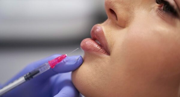 Mejores clínicas de relleno de labios - Médico estético aplicando ácido hialurónico a los labios de una mujer en una de las mejores clínicas estéticas Madrid