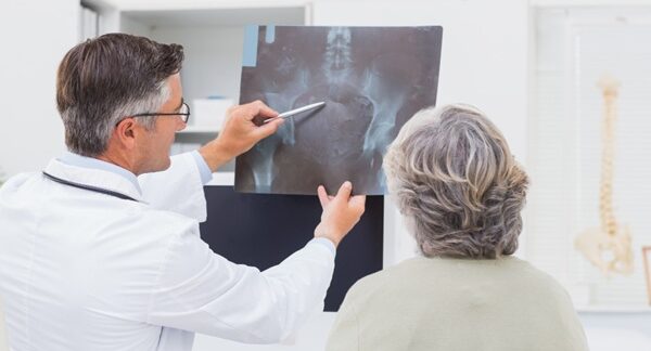 Osteoporosis - Médico especialista evaluando la radiografía de una mujer con pérdida de masa ósea en uno de los mejores centros de osteoporosis de Madrid