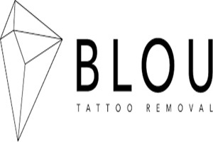 Centros de eliminación de tatuajes - Blou Tattoo Removal
