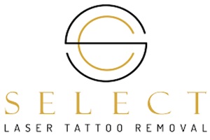 Centros de eliminación de tatuajes - Select Laser Tattoo